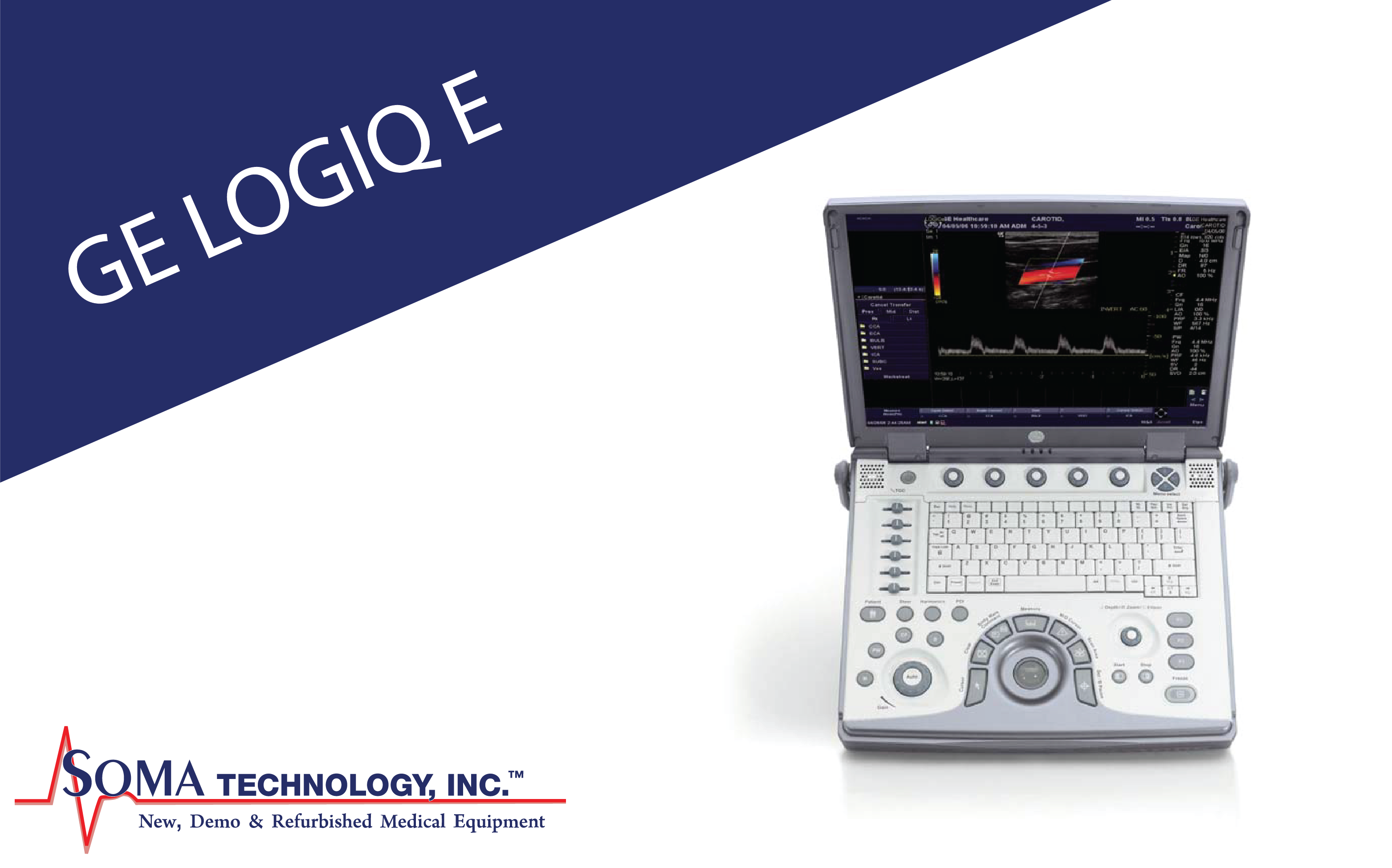 GE LOGIQ E - Portable Ultrasound Machine - Soma Technology, Inc.