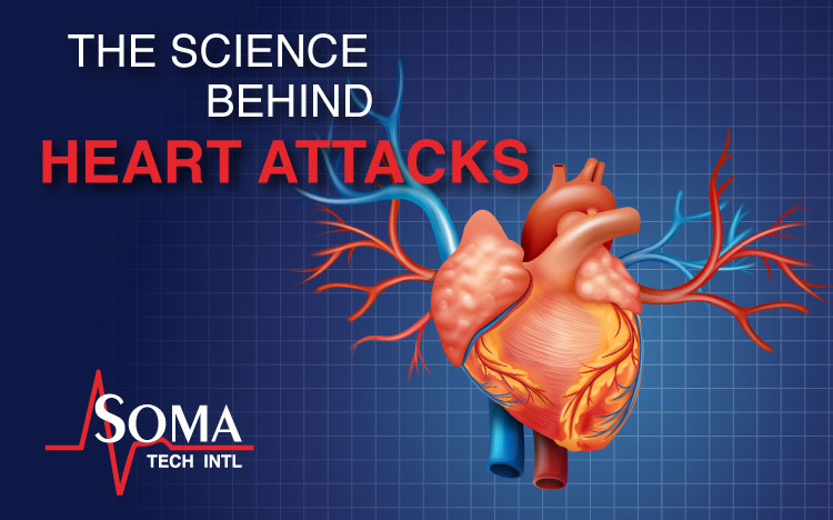 The Science Behind Heart Attacks