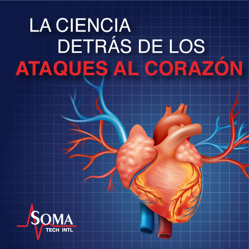 La Ciencia Detrás De Los Ataques Al Corazón