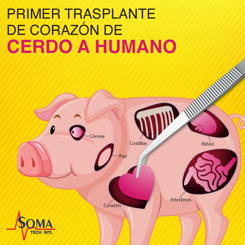 El Primer Trasplante De Corazón De Cerdo A Humano