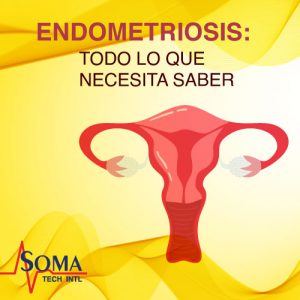 Endometriosis: Todo lo que Necesita Saber