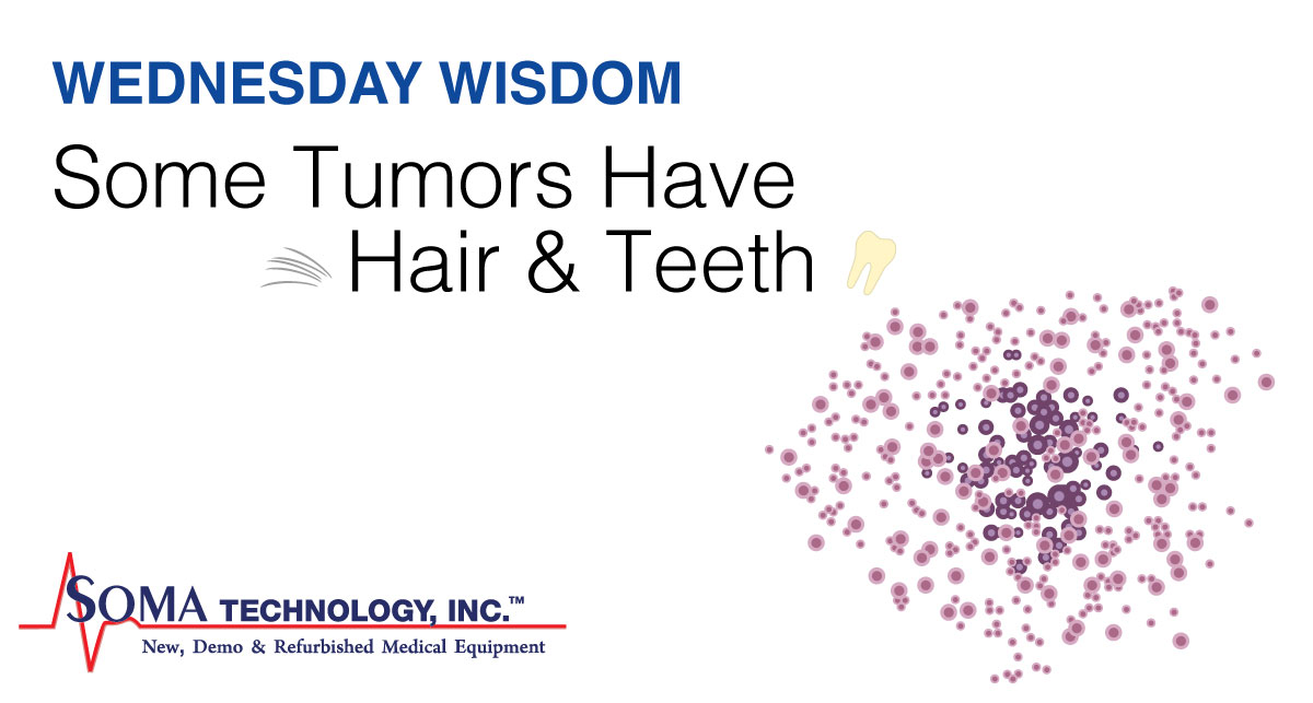 Wednesday Wisdom: Some Tumors Have Hair and Teeth Wednesday Wisdom: Some Tumors Have Hair and Teeth