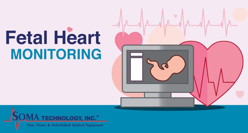 fetal heart tone monitor