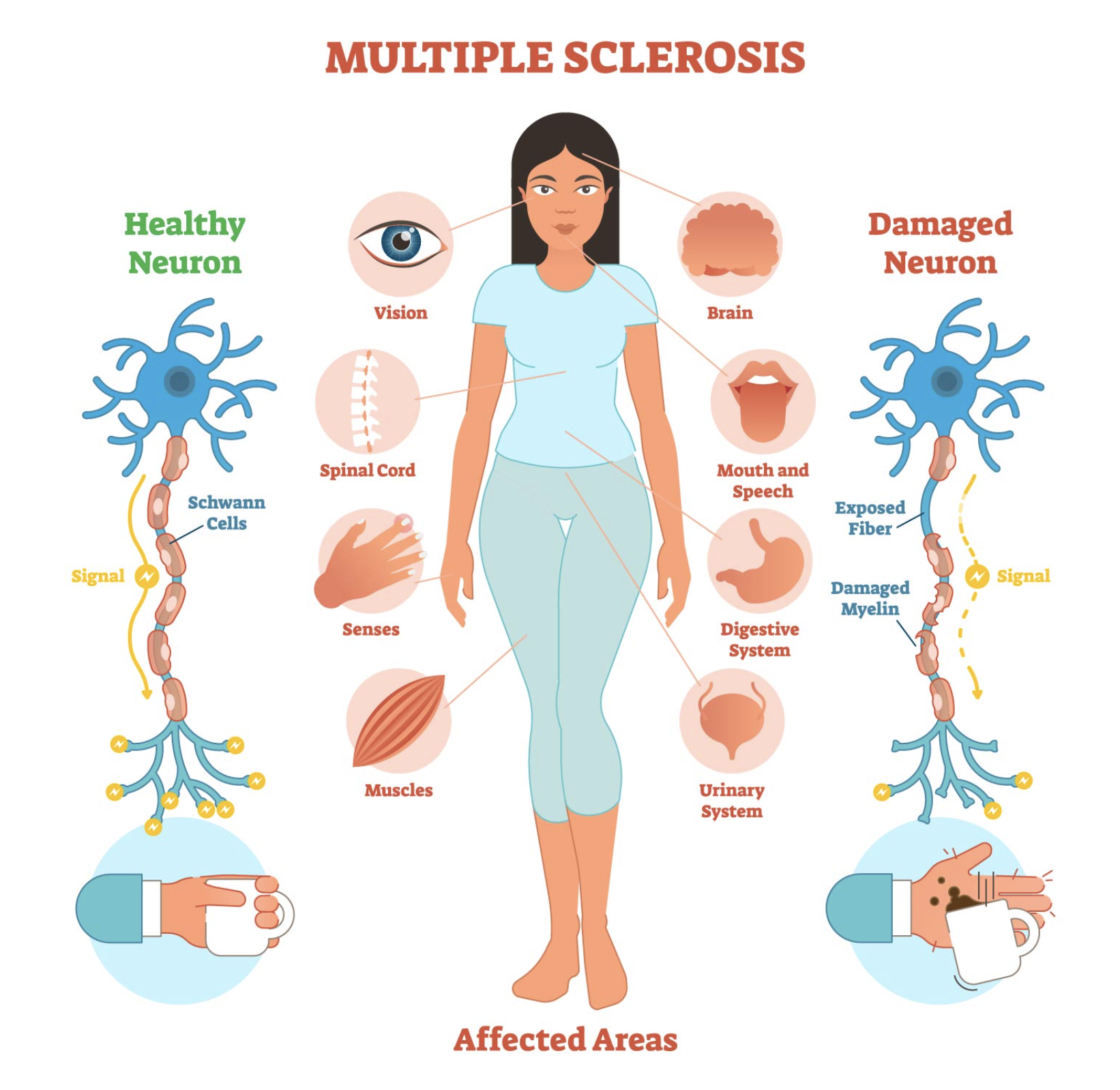 Symptoms