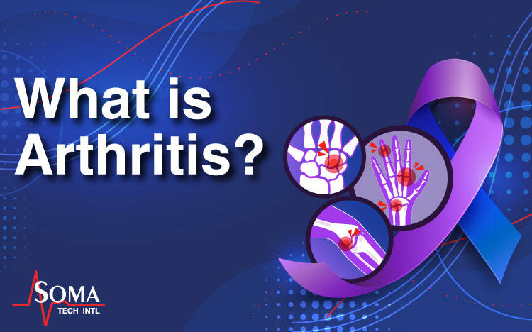 What is Arthritis?