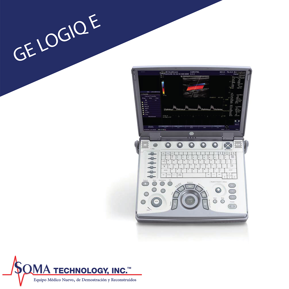 Ultrasonido Portable GE Logiq e Ultrasonido Portable GE Logiq e - Soma Technology, Inc.