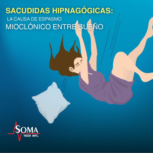 Sacudidas Hipnagógicas: La Causa De Espasmo Mioclónico Entre Sueño Sacudidas Hipnagogicas: La Causa De Espasmo Mioclonico Entre Sueno