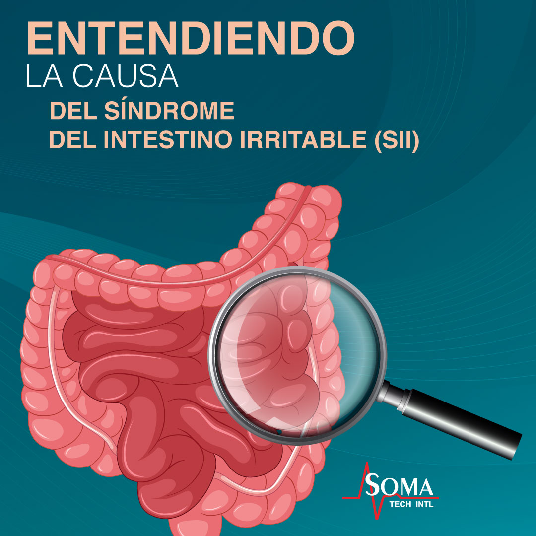 Entendiendo La Causa Del Síndrome Del Intestino Irritable (SII) Entendiendo La Causa Del Síndrome Del Intestino Irritable (SII)
