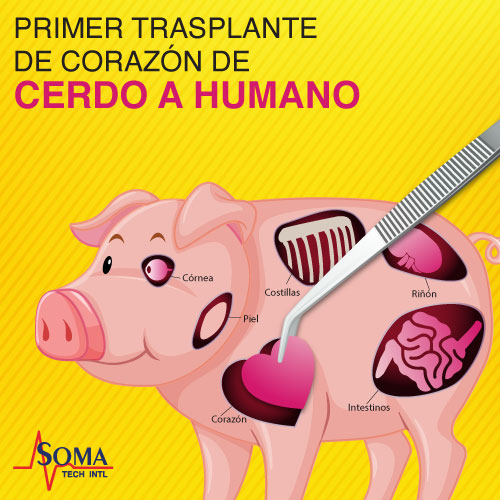 Corazón De Cerdo: El Primer Trasplante De Corazón De Cerdo A Humano El Primer Trasplante De Corazón De Cerdo A Humano