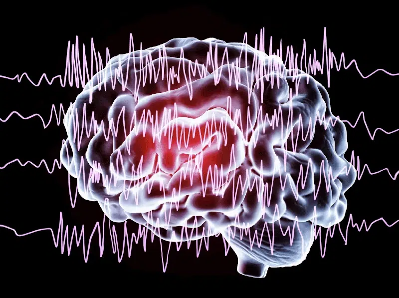 Día Púrpura: La Importancia de La Concienciación Sobre La Epilepsia 4 Tratamiento
