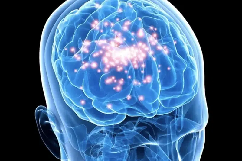 Día Púrpura: La Importancia de La Concienciación Sobre La Epilepsia 1 epilepsia