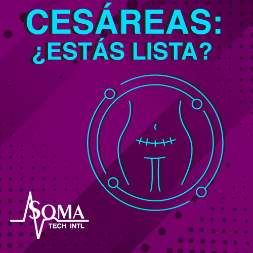 Cesáreas: ¿Estás Lista? Cesáreas: ¿Estás Lista?