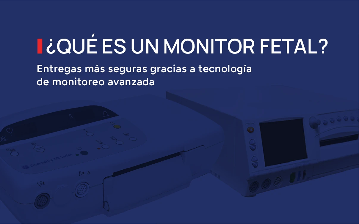 ¿Qué es un monitor fetal? ¿Qué es un monitor fetal?